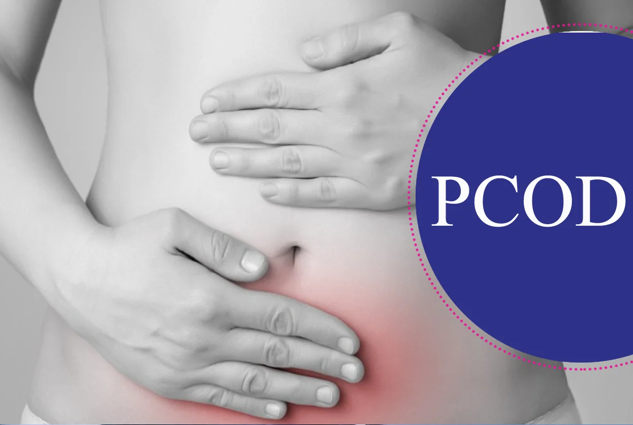 PCOD Treatment
